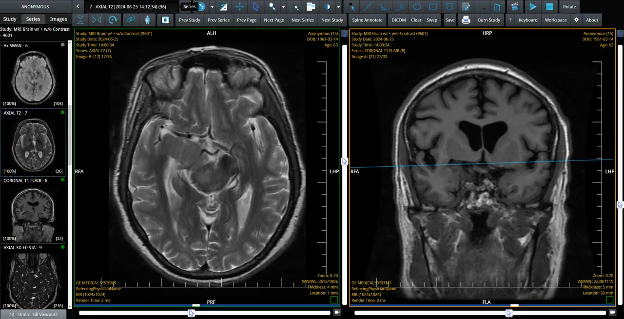 Web Viewer
